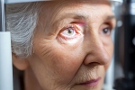 Glaucoma, Glaucoma symptoms, all about the eye disease glaucoma, Eyes