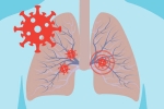 virus, Covid-19, how does covid 19 affect different parts of the body, Neurology