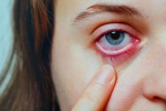 Special Measures To Prevent Conjunctivitis