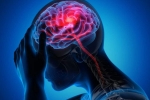 Canada Brain Disease news, Canada Brain Disease symptoms, canada is hit by a mysterious brain disease, Canada brain disease