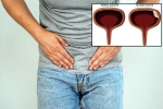 Bladder Cancer health checkup, Bladder Cancer symptoms, why is bladder cancer common in men, Bladder cancer