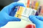 technology, CSIR, everything about feluda a low cost covid 19 test in india, Cgi